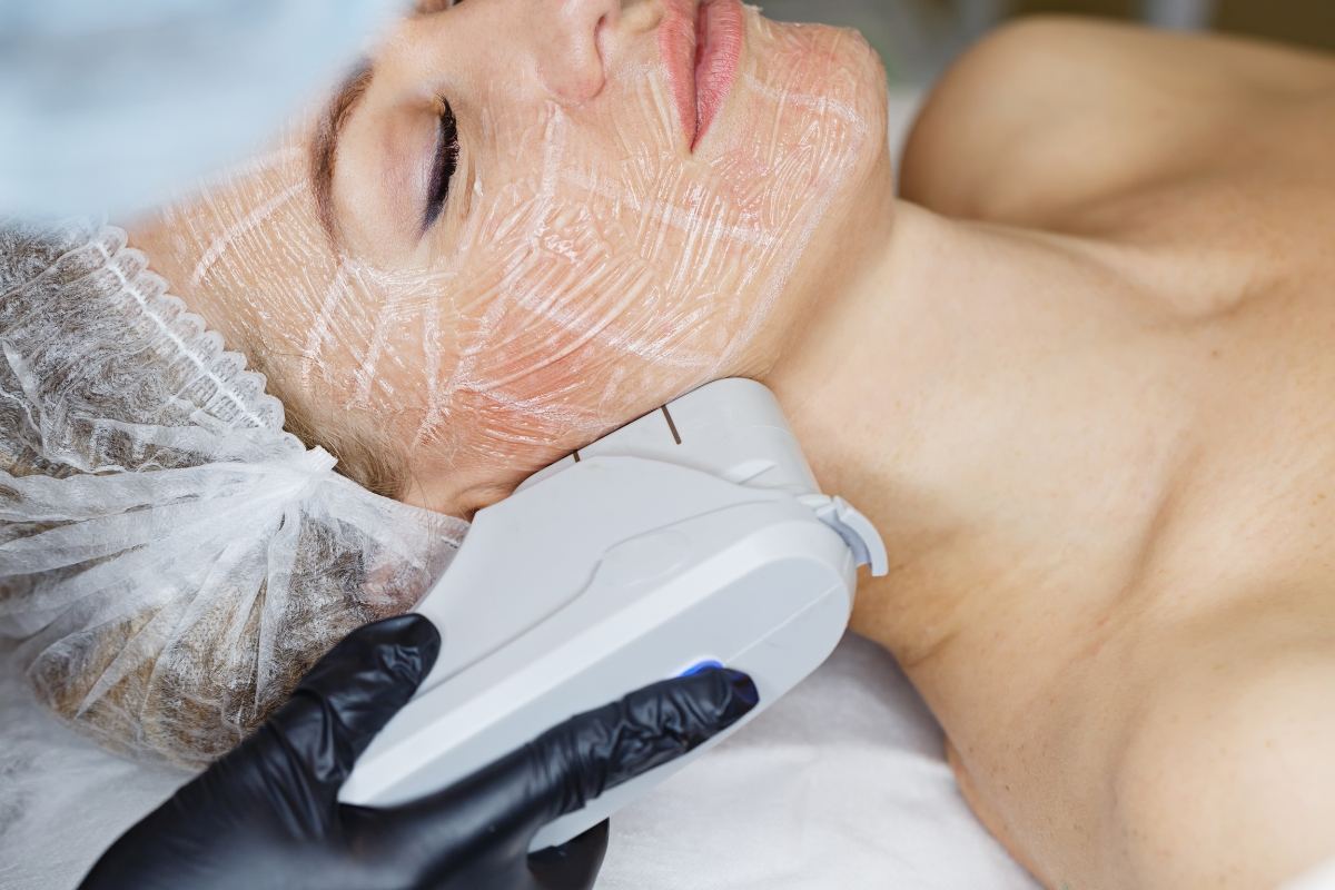 HIFU Skin Tightening