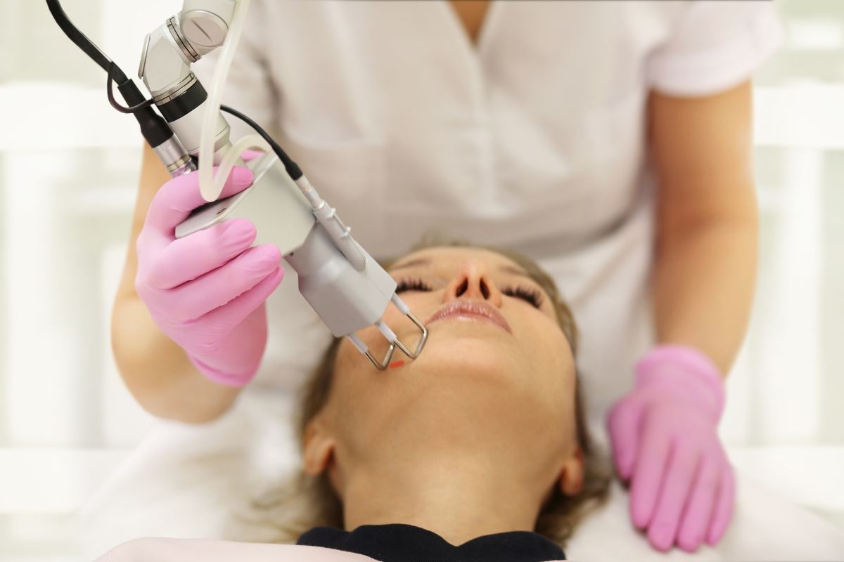 LASERS Treatment for Scars